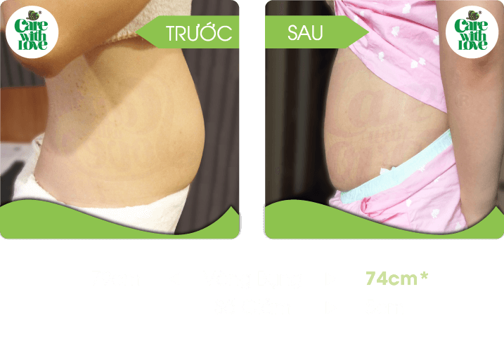 Chị Thùy, Săn chắc sau sinh 15 buổi