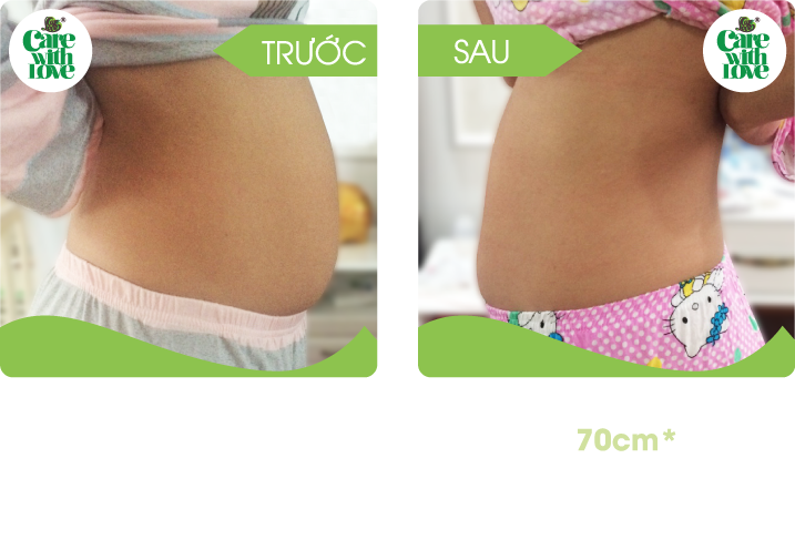 Chị Dung, Toàn diện sau sinh 15 buổi