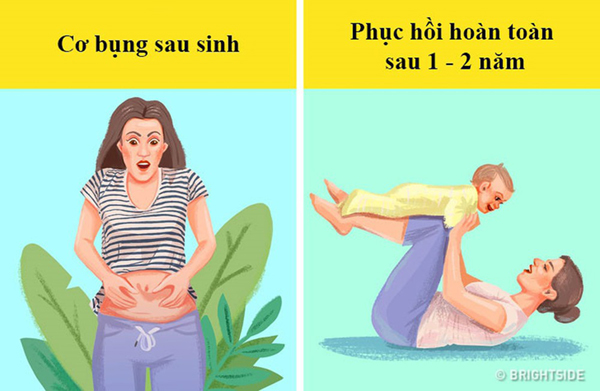 Cơ bụng sau khi sinh